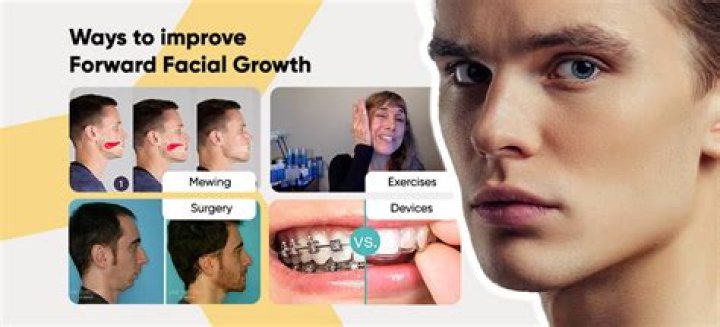 How to Get Facial Forward Growth in Puberty: A Comprehensive Guide